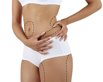 liposuccion-y-remodelaje-corporal-16 liposuccion - Clínica Aguilar Rosell Torremolinos